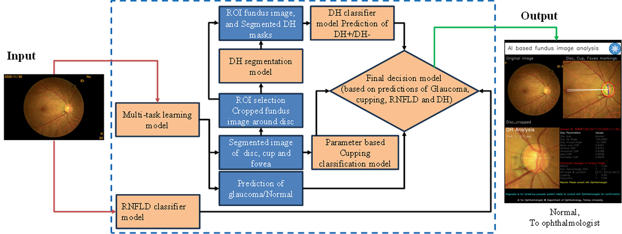 AI-GS diagram showing several lightweight models analyzing glaucoma-related structural features in a fundus photograph and combining their outputs into a final screening decision.